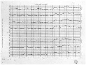 Example image of the Burst Receiver Hourly Plots on Microfilm data collection.